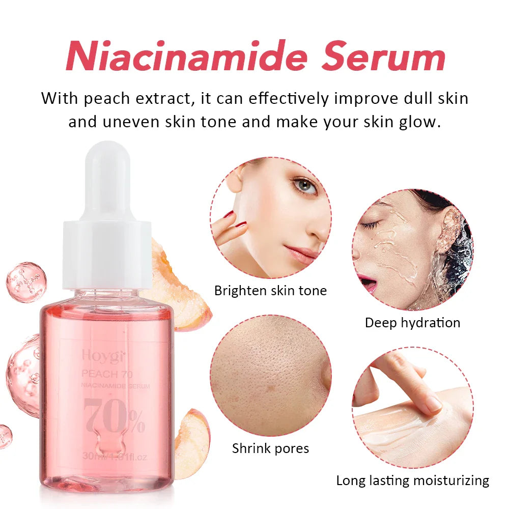 30ml Niacinamide Serum – Dark Spot Corrector, Melanin Removal & Pore-Shrinking Hydrating Skin Care