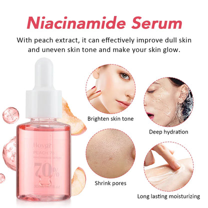 30ml Niacinamide Serum – Dark Spot Corrector, Melanin Removal & Pore-Shrinking Hydrating Skin Care