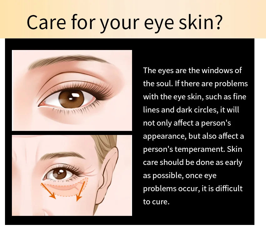 Micro-Needle Hyaluronic Acid Eye Patch – Anti-Wrinkle Moisturizing Eye Mask for Fine Lines Removal