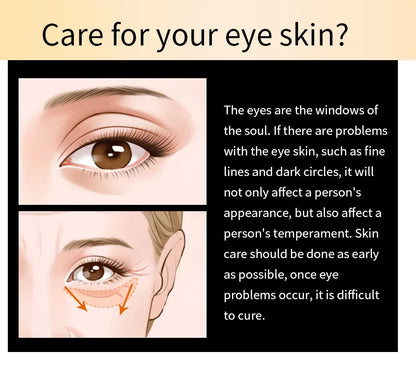 Micro-Needle Hyaluronic Acid Eye Patch – Anti-Wrinkle Moisturizing Eye Mask for Fine Lines Removal