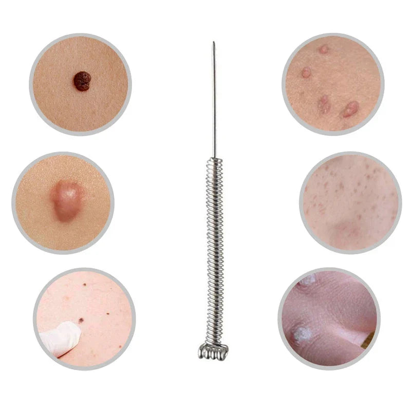 50/100pcs Sterile Surgical Needles for Mini Mole Removal Pen – Spot, Freckle & Plasma Point Beauty Accessories