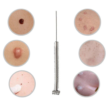 50/100pcs Sterile Surgical Needles for Mini Mole Removal Pen – Spot, Freckle & Plasma Point Beauty Accessories