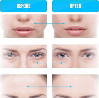 GESS Microcurrent Facial Device — Anti-Aging Face & Neck Massager for Home and Office Skin Care