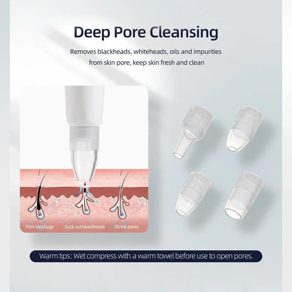 Professional Diamond Microdermabrasion Machine – At-Home Facial Peeling & Deep Cleaning Skin Care Tool