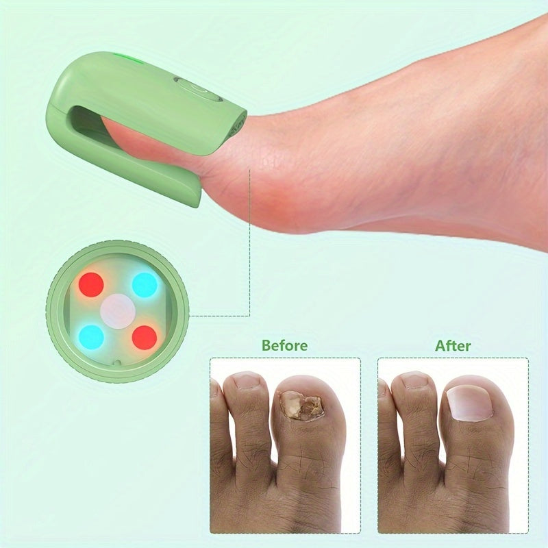 Portable Nail Fungus Cleaning Laser Device – Home Use for Men & Women, Effective Treatment for Nail Fungus